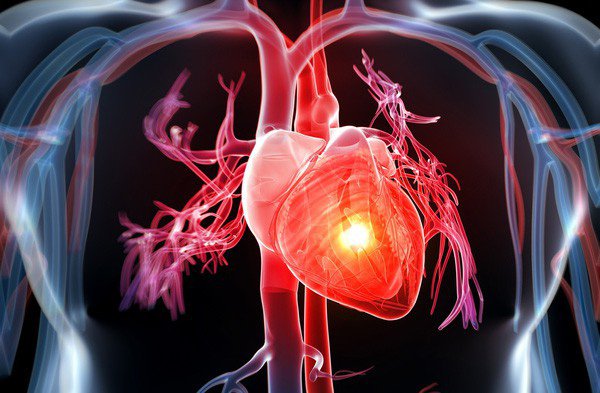 Bệnh lý tim mạch: nguyên nhân gây tử vong hàng đầu | Vinmec
