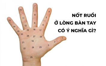Nốt Ruồi Trong Lòng Bàn Tay Phải & Trái Ở Nam & Nữ Có Ý Nghĩa Gì?